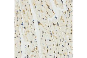 Immunohistochemistry (IHC) image for anti-Myb-Like, SWIRM and MPN Domains 1 (MYSM1) (C-Term) antibody (ABIN3017376) (MYSM1 antibody  (C-Term))