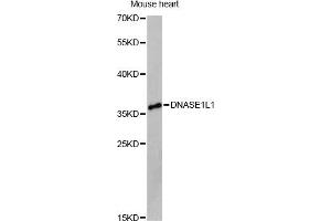 Western blot analysis of extracts of mouse heart, using DNASE1L1 Antibody (ABIN6292459) at 1:3000 dilution. (DNASEX antibody)