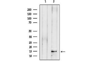 anti-Presenilin Enhancer 2 Homolog (PSENEN) (Internal Region) antibody