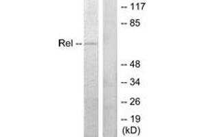Western blot analysis of extracts from MDA-MB-435 cells, using Rel (Ab-503) Antibody.