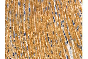 ABIN6259163 and ABIN6274159 at 1/100 staining Rat heart tissue by IHC-P. (TACSTD2 antibody  (Internal Region))