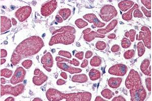 Immunohistochemistry (IHC) image for anti-phosphodiesterase 4D, cAMP-Specific (PDE4D) (C-Term) antibody (ABIN185530)