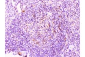 IHC testing of FFPE rat spleen tissue with MMP11 antibody at 1ug/ml. (MMP11 antibody  (AA 104-135))