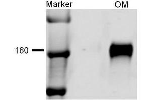 Western blot analysis of Rat kidney tissue lysates showing detection of NKCC2 protein using Rabbit Anti-NKCC2 Polyclonal Antibody . (SLC12A1 antibody  (AA 33-55) (FITC))
