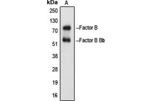 Western blot analysis of Factor B Bb expression in Raji Etoposide-treated (A) whole cell lysates. (Complement B + Bb (Center) antibody)