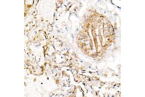 Immunohistochemistry of paraffin-embedded human lung using BST2 Rabbit pAb (ABIN6129547, ABIN6137673, ABIN6137675 and ABIN6215924) at dilution of 1:100 (40x lens). (BST2 antibody  (AA 49-161))