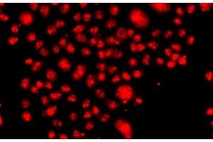 Immunofluorescence analysis of A549 cells using FANCM Polyclonal Antibody (FANCM antibody)