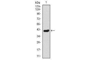 Image no. 1 for anti-Twist Homolog 1 (Drosophila) (TWIST1) antibody (ABIN1491700) (TWIST1 antibody)