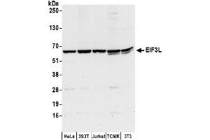Western Blotting (WB) image for anti-Eukaryotic Translation Initiation Factor 3, Subunit L (EIF3L) (AA 1-50) antibody (ABIN7450199)