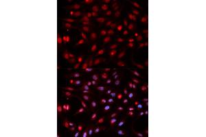 Immunofluorescence analysis of HeLa cell using APEX1 antibody. (APEX1 antibody)
