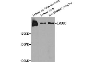 Western blot analysis of extracts of various cell lines, using ERBB3 antibody (ABIN1876761) at 1:1000 dilution. (ERBB3 antibody)