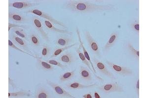 Immunocytochemistry analysis of Hela cells using ABIN7139153 at dilution of 1:100 (HIST1H4A antibody  (acLys12))