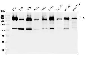 Western blot analysis of Periplakin using anti-Periplakin antibody (ABIN5518787). (PPL antibody  (C-Term))