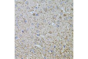 Immunohistochemistry of paraffin-embedded mouse brain using TEFM antibody. (TEFM antibody  (AA 36-210))