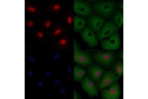 ABIN6263605 and ABIN6276415 staining  cells by IF/ICC. (NeuN antibody  (C-Term))