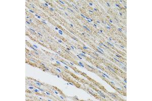 Immunohistochemistry of paraffin-embedded mouse heart using MYOT antibody (ABIN5973839) at dilution of 1/100 (40x lens). (Myotilin antibody)