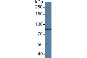 Western Blot; Sample: Mouse Kidney lysate; Primary Ab: 1. (Neuropilin 1 antibody  (AA 27-141))