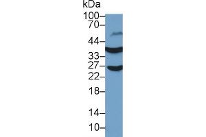 Detection of GAPDH in Human Liver lysate using Polyclonal Antibody to Glyceraldehyde-3-Phosphate Dehydrogenase (GAPDH) (GAPDH antibody  (AA 154-324))