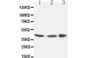Anti-Connexin 43/GJA1 antibody, Western blotting Lane 1: Rat Cardiac Muscle Tissue Lysate Lane 2: Rat Cardiac Muscle Tissue Lysate Lane 3: Rat Brain Tissue Lysate (Connexin 43/GJA1 antibody  (C-Term))