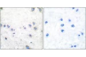 Immunohistochemistry analysis of paraffin-embedded human brain, using COT (Phospho-Thr290) Antibody. (CROT antibody  (pThr290))