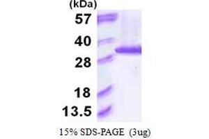 SDS-PAGE (SDS) image for Proteasome Subunit alpha 6 (PSMA6) (AA 1-246) protein (His tag) (ABIN666621) (PSMA6 Protein (AA 1-246) (His tag))