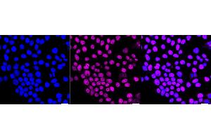 anti-Hypoxia Inducible Factor 1, alpha Subunit Inhibitor (HIF1AN) antibody