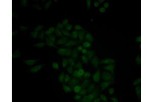 Immunofluorescence analysis of MCF-7 cells using CTSE antibody. (Cathepsin E antibody)