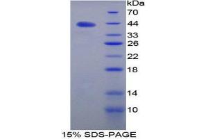 SDS-PAGE (SDS) image for Natriuretic Peptide Type C (NPPC) (AA 30-126) protein (His tag,GST tag) (ABIN2122521)