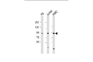 All lanes : Anti-NUP93 Antibody (N-Term) at 1:2000 dilution Lane 1: F9 whole cell lysate Lane 2: Jurkat whole cell lysate Lane 3: K562 whole cell lysate Lysates/proteins at 20 μg per lane.