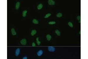 Immunofluorescence analysis of U-2 OS cells using MKL1 Polyclonal Antibody at dilution of 1:100 (40x lens). (MKL1 antibody)