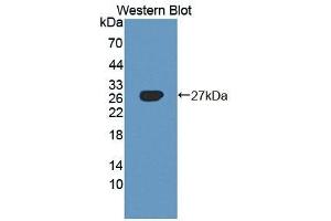 Detection of Recombinant AXL, Rat using Polyclonal Antibody to AXL Receptor Tyrosine Kinase (AXL) (AXL antibody  (AA 21-202))