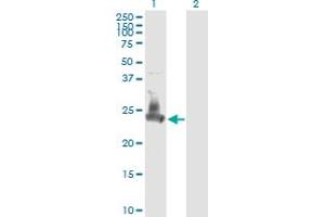 Western Blotting (WB) image for anti-Synaptosomal-Associated Protein, 23kDa (SNAP23) (AA 1-211) antibody (ABIN563782)