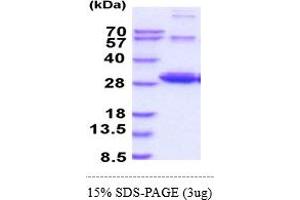 SDS-PAGE (SDS) image for Ras-related Protein Ral-A (rala) (AA 1-203) protein (His tag) (ABIN5855037)