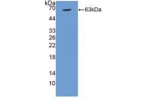 Western blot analysis of recombinant Human CCND1. (Cyclin D1 antibody  (AA 1-295))