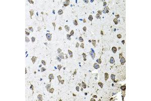 Immunohistochemistry of paraffin-embedded mouse brain using FGF1 antibody at dilution of 1:100 (x40 lens). (FGF1 antibody)