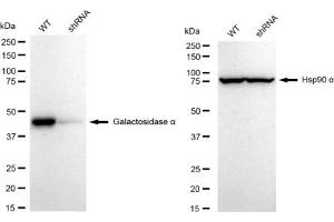 Western blotting analysis using Galactosidase alpha antibody (ABIN7798683).
