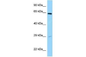 WB Suggested Anti-SNX11 Antibody Titration: 1. (SNX11 antibody  (Middle Region))