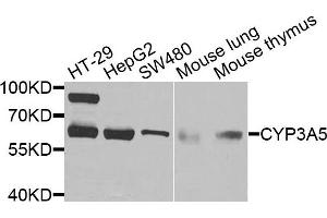 Western blot analysis of extracts of various cells, using CYP3A5 antibody. (CYP3A5 antibody)