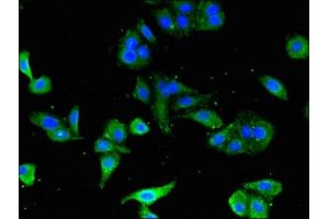 Immunofluorescence (IF) image for anti-CD247 Molecule (CD247) (AA 88-153) antibody (ABIN7171394)