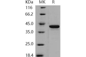 STK10-A Protein (His tag)