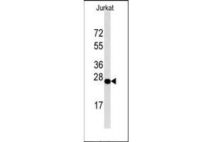 Image no. 1 for anti-DNA-Damage-Inducible Transcript 4 (DDIT4) (C-Term), (N-Term) antibody (ABIN358765) (DDIT4 antibody  (C-Term, N-Term))