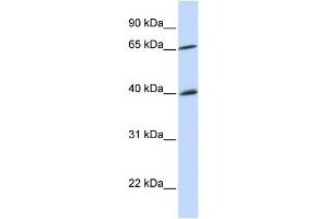 WB Suggested Anti-CHEK2 Antibody Titration:  0. (CHEK2 antibody  (N-Term))