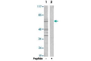 Western blot analysis of extracts from A-549 cells, using CERKL polyclonal antibody .