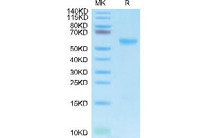 Biotinylated Human APRIL Trimer on Tris-Bis PAGE under reduced condition. (TNFSF13 Protein (Trimer) (His-Avi-DYKDDDDK Tag,Biotin))