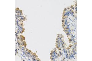 Immunohistochemistry of paraffin-embedded mouse lung using IL25 antibody at dilution of 1:100 (40x lens). (IL-25 antibody)