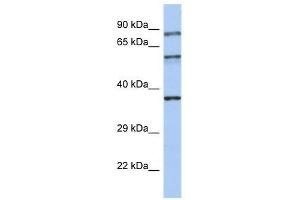 Western Blot showing RPH3A antibody used at a concentration of 1-2 ug/ml to detect its target protein. (RPH3A antibody  (N-Term))