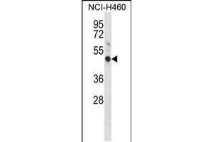 Western blot analysis in NCI-H460 cell line lysates (35ug/lane). (GYPE antibody  (C-Term))