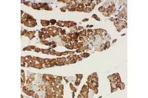 Anti-NDUFA1 antibody, IHC(P) IHC(P): Rat Cardiac Muscle Tissue