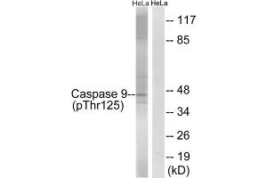 Western blot analysis of extracts from HeLa cells, treated with TNF (20ng/ml, 5mins) and calyculinA (50ng/ml, 15mins), using Caspase 9 (Phospho-Thr125) antibody. (Caspase 9 antibody  (pThr125))