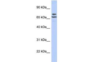 Human SH-SYSY; WB Suggested Anti-C3orf39 Antibody Titration: 0.